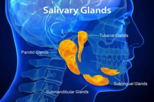 What Is Adenoid Cystic Carcinoma?