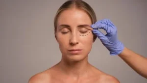 Understanding under eye laser treatment: What you need to know