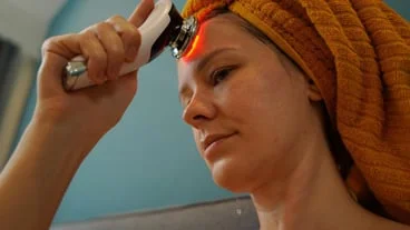 What you need to know about laser dark circle removal