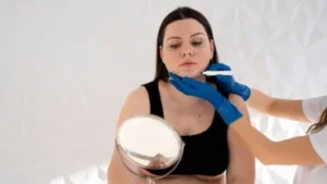 Understanding CoolSculpting for a Double Chin