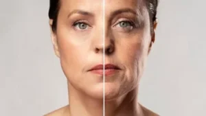 Effective strategies for removing face wrinkles